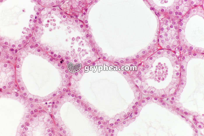 Glande lacrymale x100 - gryphea.com